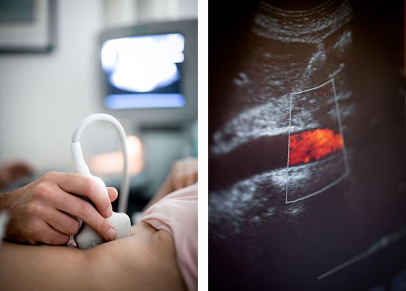 GIJ0404Sonografie3